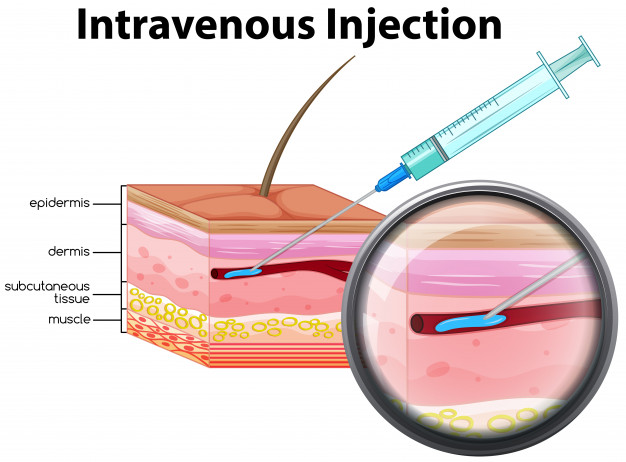 Types Of Injection Techniques Hvax Turnkey Pharma Projects